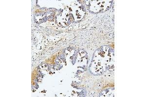 IHC analysis of TEK using anti-TEK antibody (ABIN7600762). (TEK antibody  (AA 23-616))