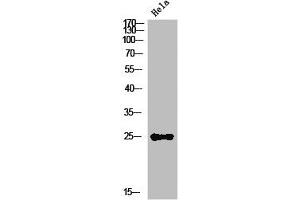 Western Blot analysis of HeLa cells using IL-12A Polyclonal Antibody (IL12A antibody  (Internal Region))