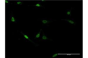 Immunofluorescence of monoclonal antibody to ZNF76 on HeLa cell. (ZNF76 antibody  (AA 471-570))