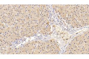 Detection of ADRP in Human Liver Tissue using Polyclonal Antibody to Adipose Differentiation Related Protein (ADRP) (ADRP antibody  (AA 5-232))