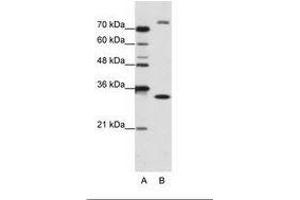 Image no. 1 for anti-Exosome Component 2 (EXOSC2) (N-Term) antibody (ABIN202179) (EXOSC2 antibody  (N-Term))