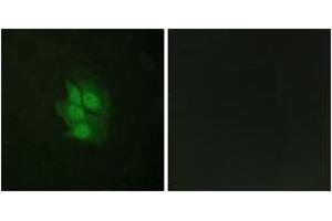 Immunofluorescence (IF) image for anti-Tumor Protein P53 (TP53) (AA 344-393), (pSer392) antibody (ABIN1531357)