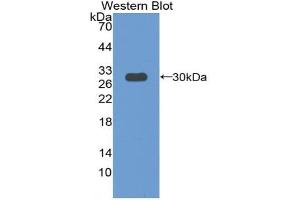 Western blot analysis of the recombinant protein. (Paxillin antibody  (AA 347-578))