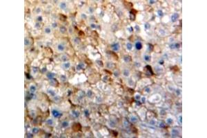 IHC-P analysis of Liver tissue, with DAB staining. (IGSF1 antibody  (AA 1008-1227))