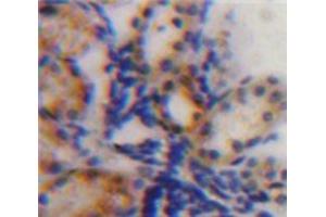 IHC-P analysis of Kidney tissue, with DAB staining. (IGFBP2 antibody  (AA 35-304))