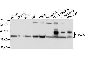 Western blot analysis of extracts of various cells, using NACA antibody.