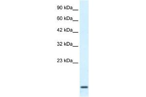 WB Suggested Anti-HOXA1 Antibody Titration:  2. (HOXA1 antibody  (Middle Region))
