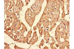 Immunohistochemistry of paraffin-embedded human heart tissue using ABIN7156142 at dilution of 1:100 (IPO13 antibody  (AA 501-700))