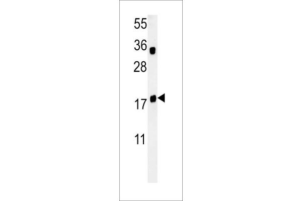 TRAPPC6A 抗体  (N-Term)