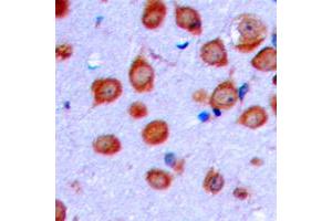 Immunohistochemical analysis of OLFML2A staining in human brain formalin fixed paraffin embedded tissue section. (OLFML2A antibody  (Center))