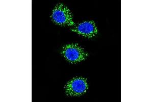 Confocal immunofluorescent analysis of P3 Antibody (C-term) (ABIN656992 and ABIN2846173) with MDA-M cell followed by Alexa Fluor 488-conjugated goat anti-rabbit lgG (green). (MPP3 antibody  (C-Term))