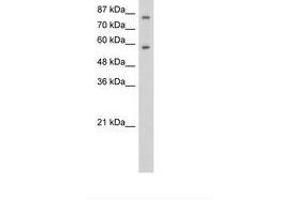 Image no. 1 for anti-Zinc Finger Protein 777 (ZNF777) (C-Term) antibody (ABIN6736254) (ZNF777 antibody  (C-Term))