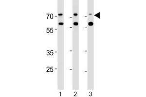 Acetylcholinesterase antibody western blot analysis in human 1) Jurkat, 2) Raji and 3) Y79 lysate. (Acetylcholinesterase antibody  (AA 147-175))