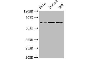 Western Blot Positive WB detected in: Hela whole cell lysate, Jurkat whole cell lysate, 293 whole cell lysate All lanes: INTS9 antibody at 1:2000 Secondary Goat polyclonal to rabbit IgG at 1/50000 dilution Predicted band size: 74, 72 kDa Observed band size: 74 kDa (INTS9 antibody  (AA 368-658))