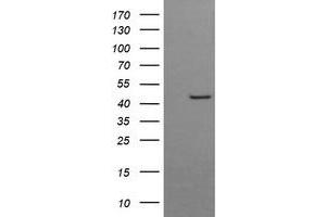 Image no. 2 for anti-butyrobetaine (Gamma), 2-Oxoglutarate Dioxygenase (Gamma-butyrobetaine Hydroxylase) 1 (BBOX1) antibody (ABIN1496815) (BBOX1 antibody)