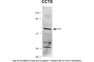 Sample Type: HEK 293 (10ug)Primary Dilution: 1:1000Secondary Antibody: conjugated goat anti-rabbitSecondary Dilution: 1:10,000Image Submitted By: Amy GrayBrigham Young University (CCT8 antibody  (C-Term))