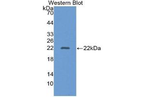 Western Blotting (WB) image for anti-Alanine Aminotransferase (ALT) (AA 581-738) antibody (ABIN1862085)