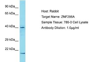Host: Rabbit Target Name: ZNF286A Sample Tissue: Human 786-0 Whole Cell Antibody Dilution: 1ug/ml