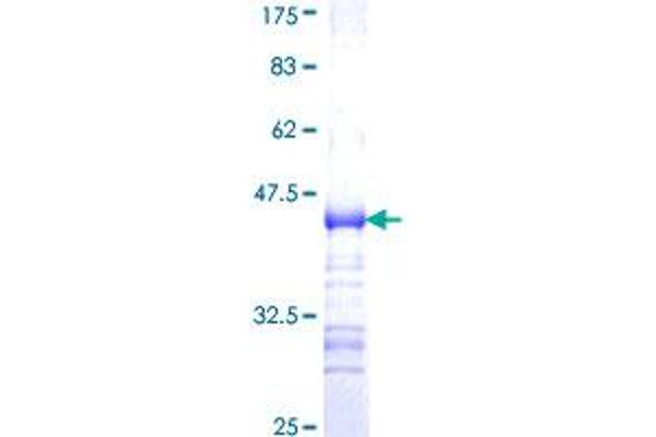 ADAMTS7 Protein (AA 1589-1686) (GST tag)