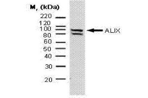 Western Blotting (WB) image for anti-Programmed Cell Death 6 Interacting Protein (PDCD6IP) antibody (ABIN181090) (ALIX antibody)