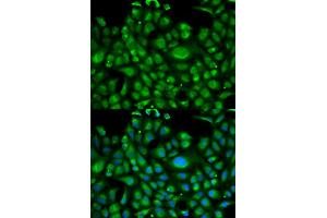 Immunofluorescence analysis of U2OS cells using HSPA1L antibody (ABIN5970952). (HSPA1L antibody)