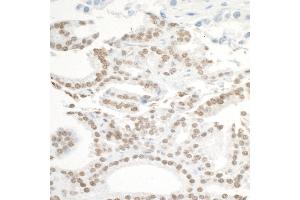Immunohistochemistry (IHC) image for anti-Bromodomain Containing 3 (BRD3) (AA 676-726) antibody (ABIN7453851) (BRD3 antibody  (AA 676-726))