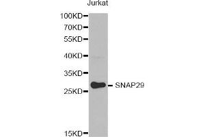 Western Blotting (WB) image for anti-Synaptosomal-Associated Protein, 29kDa (SNAP29) antibody (ABIN1874886)