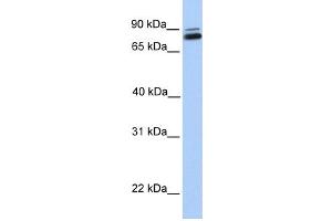 WB Suggested Anti-GGTL3 Antibody Titration:  0.