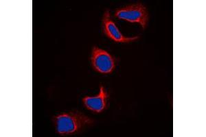 Immunofluorescent analysis of IFITM3 staining in HeLa cells.
