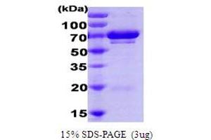 SDS-PAGE (SDS) image for Ubiquitin-Conjugating Enzyme E2G 2 (UBE2G2) protein (ABIN666841)