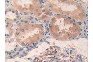 DAB staining on IHC-P; Samples: Human Kidney Tissue (AMP Activated Protein Kinase Alpha2 (AA 252-493) antibody)