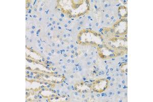 Immunohistochemistry of paraffin-embedded rat kidney using HS1BP3 antibody at dilution of 1:100 (x40 lens). (HS1BP3 antibody)