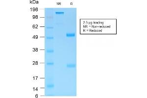 SDS-PAGE Analysis Purified MUC6 Rabbit Recombinant Monoclonal Antibody (MUC6/1553R). (Recombinant MUC6 antibody)