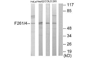 Western blot analysis of extracts from HeLa cells, HepG2 cells, COLO205 cells and 293 cells, using PFKFB1/4 antibody. (PFKFB1/4 antibody  (Internal Region))