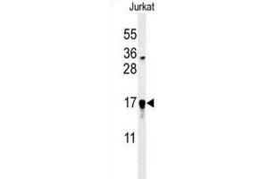 Western Blotting (WB) image for anti-Glutaredoxin 5 (GLRX5) antibody (ABIN3002211)