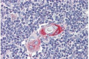 Thymus, Human: Formalin-Fixed, Paraffin-Embedded (FFPE) (CPXCR1 antibody  (AA 396-445))