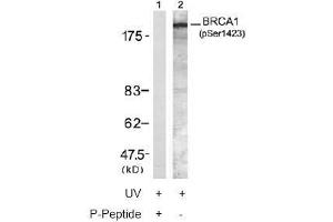 Image no. 2 for anti-Breast Cancer 1 (BRCA1) (pSer1423) antibody (ABIN196994) (BRCA1 antibody  (pSer1423))