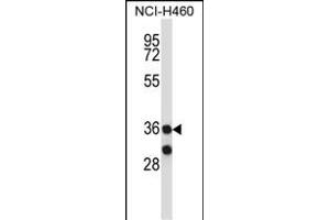 RCH11 Antibody (C-term) (ABIN657732 and ABIN2846717) western blot analysis in NCI- cell line lysates (35 μg/lane). (MARCH11 antibody  (C-Term))