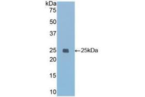 Western blot analysis of recombinant Mouse IGFBP7. (IGFBP7 antibody  (AA 88-281))