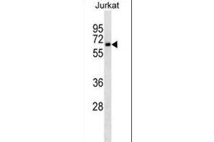 CD25 Antibody ABIN1539791 western blot analysis in Jurkat cell line lysates (35 μg/lane). (CD25 antibody)
