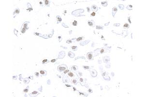 Immunocytochemistry (ICC) image for anti-Structural Maintenance of Chromosomes 1A (SMC1A) (C-Term) antibody (ABIN7455193) (Recombinant SMC1A antibody  (C-Term))