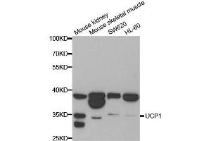 Western blot analysis of extracts of various cell lines, using UCP1 antibody. (UCP1 antibody)