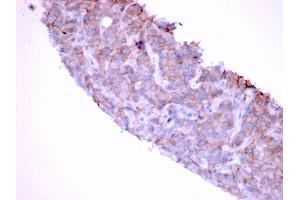 Formalin-fixed, paraffin-embedded human Bladder stained with EGFR Mouse Monoclonal Antibody (GFR/1667). (EGFR antibody)