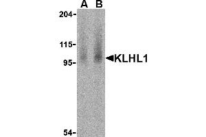 Western Blotting (WB) image for anti-Kelch-Like 1 (KLHL1) (N-Term) antibody (ABIN1031428) (KLHL1 antibody  (N-Term))