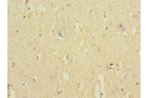 Immunohistochemistry of paraffin-embedded human brain tissue using ABIN7144208 at dilution of 1:100