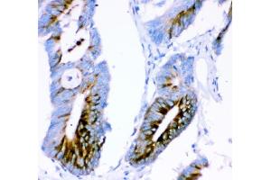 IHC analysis of Ataxin 1 using anti-Ataxin 1 antibody (ABIN3043506). (Ataxin 1 antibody  (C-Term))