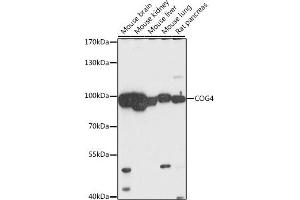 Western blot analysis of extracts of various cell lines, using COG4 antibody (ABIN7266486) at 1:1000 dilution. (COG4 antibody  (AA 310-410))