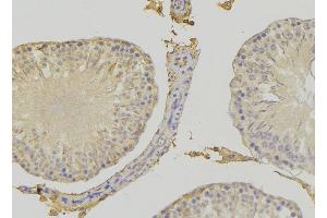 ABIN6272415 at 1/100 staining RAT testis tissue by IHC-P. (RHOBTB3 antibody  (Internal Region))