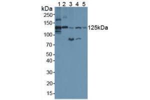Figure. (Complement C3 Convertase antibody  (AA 1314-1663))