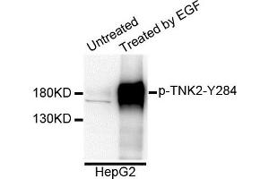 Western blot analysis of extracts of HepG2 cells, using Phospho-TNK2-Y284 antibody. (TNK2 antibody  (pTyr284))